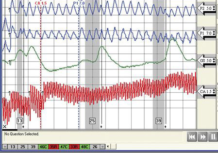 How a polygraph works